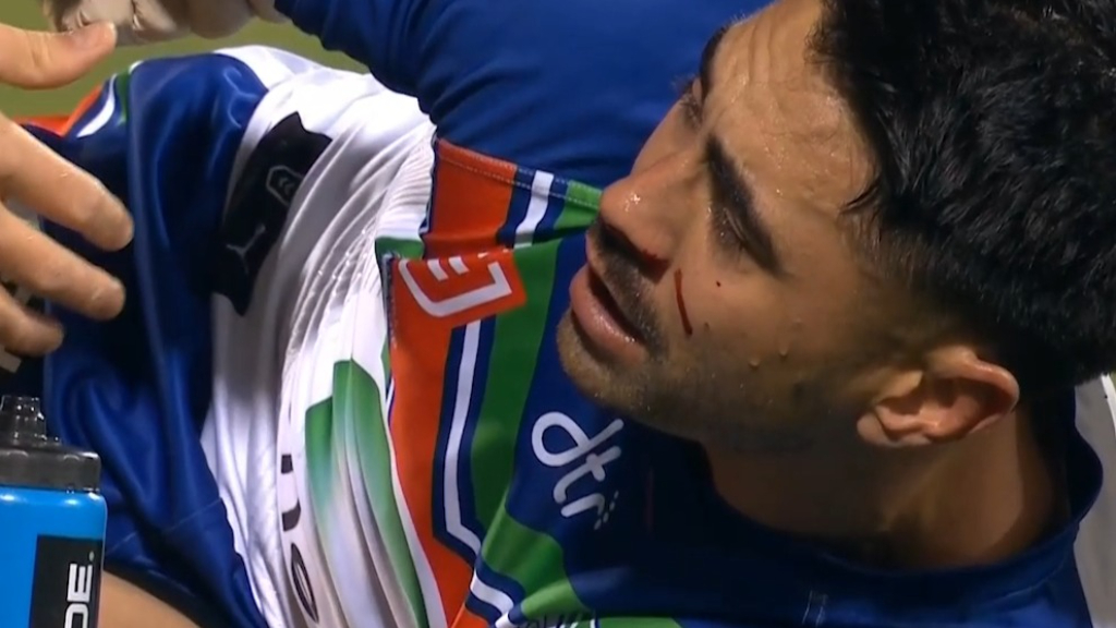 Johnson injured as Warriors score