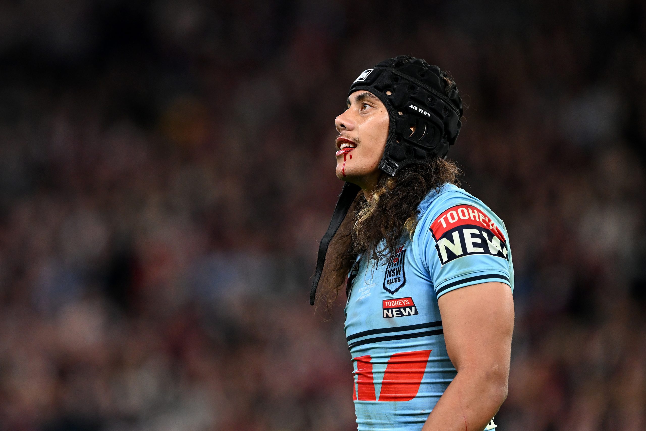 Jarome Luai leaves Suncorp Stadium with a bloody mouth after State of Origin II.