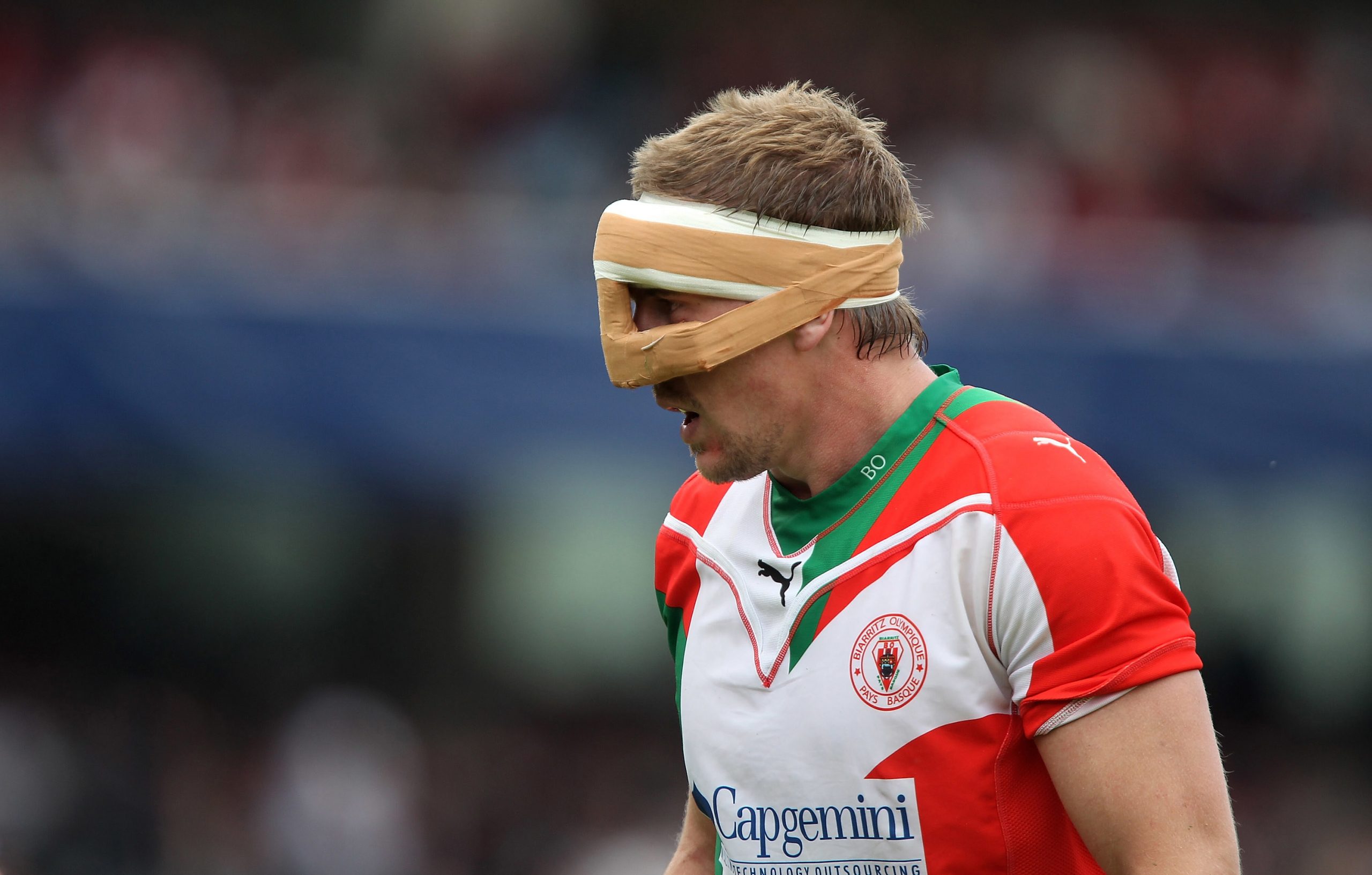 Imanol Harinordoquy of Biarritz wears a face protector in 2010.