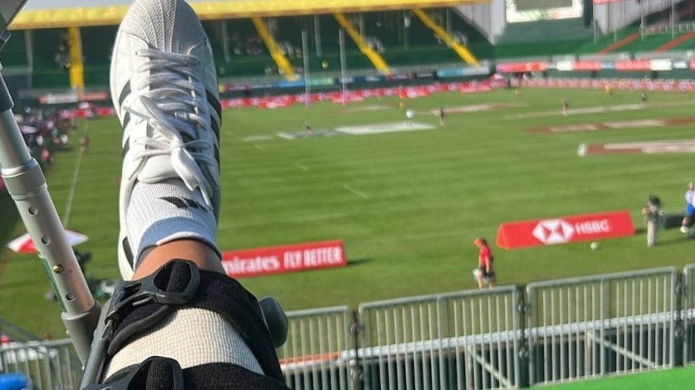 Sarah Hirini injured her right knee in the Dubai Sevens.