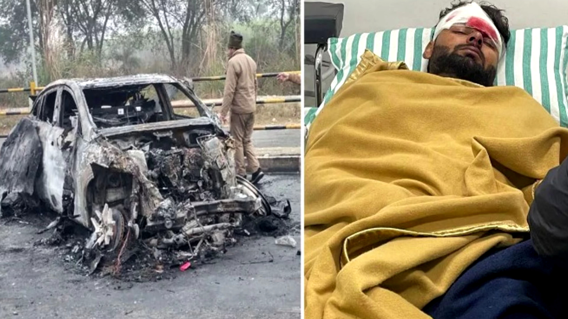 Pant survives fiery car crash
