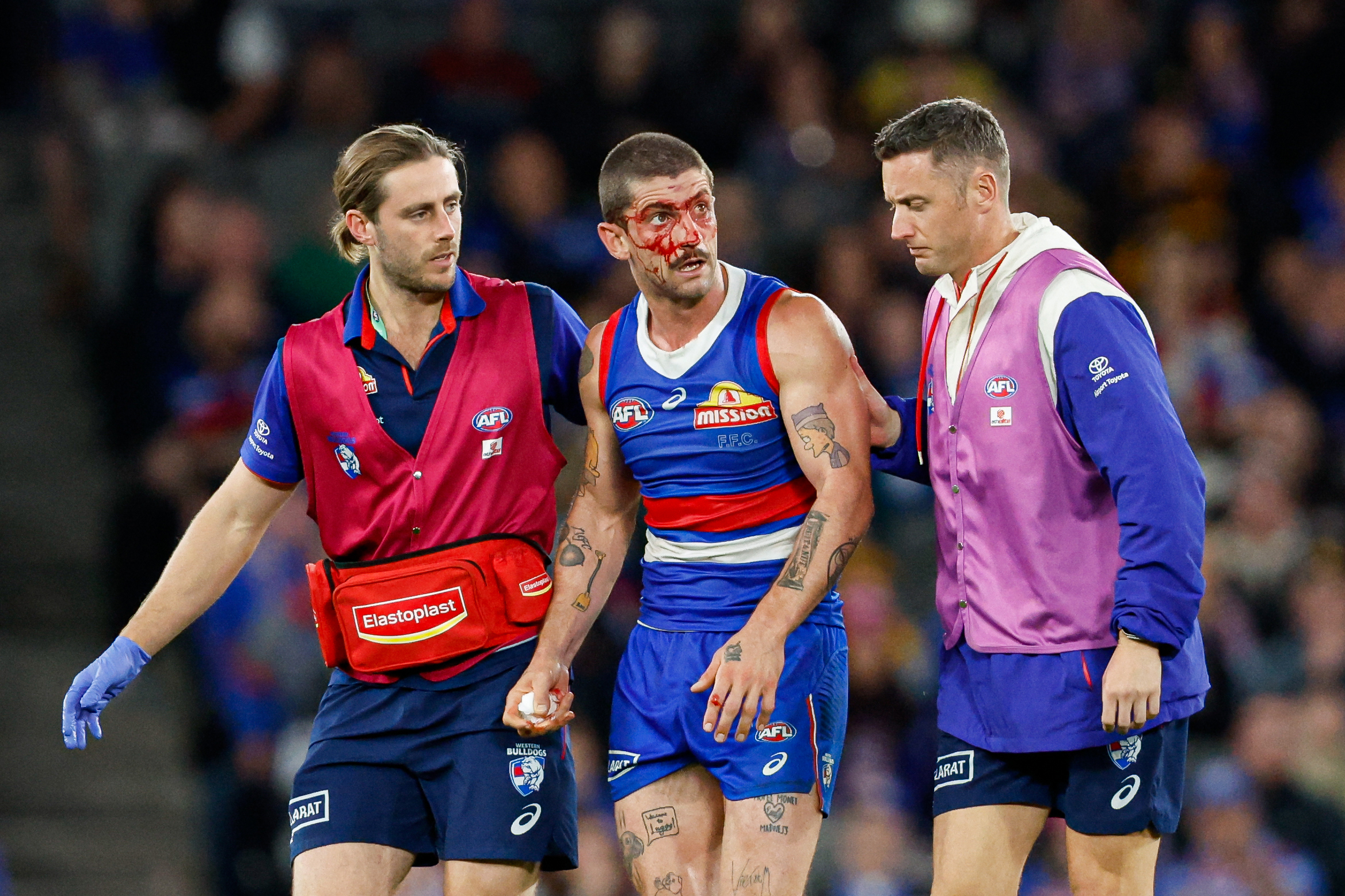 Liberatore copped a boot to the head.