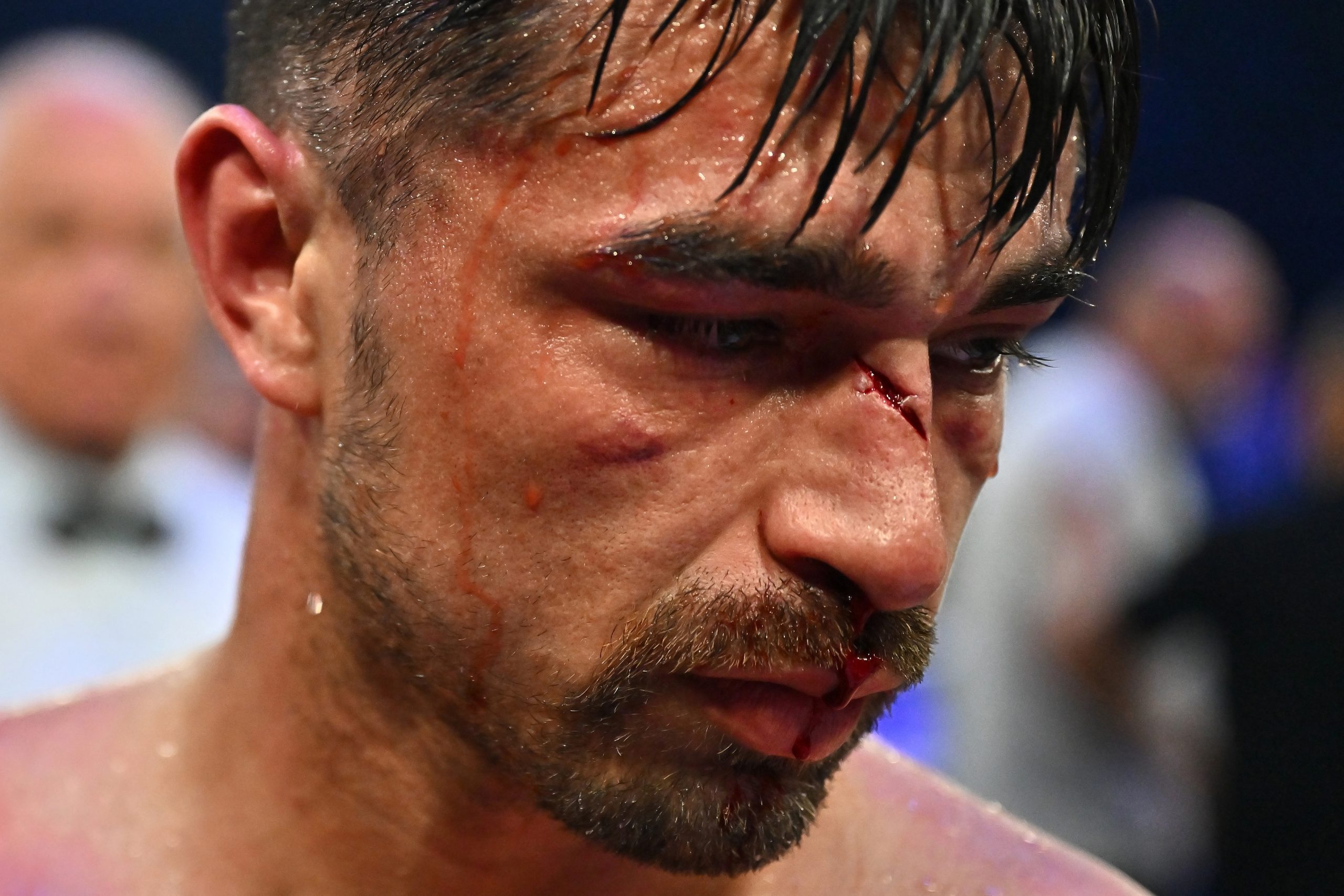 Jonathan Navarro looks on after his fight against Liam Paro in their welterweight bout at Cairns Convention Centre on June 25, 2025 in Cairns, Australia. (Photo by Emily Barker/Getty Images for No Limit Boxing)