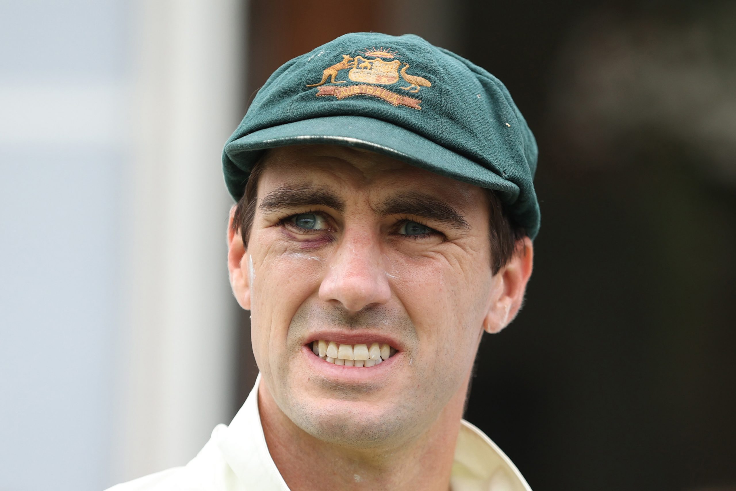 Australian skipper Pat Cummins looks on.